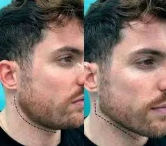 Marcación mandibular: equilibrio, estructura y carácter en la estética urbana contemporánea